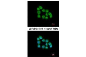 ICC/IF Image Immunofluorescence analysis of paraformaldehyde-fixed A431, using MBNL3, antibody at 1:200 dilution. (MBNL3 antibody)