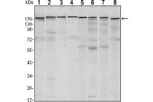 Western blot analysis using SETDB1 mouse mAb against MCF-7 (1),T47D (2), HEK293 (3), JURKAT (4), NIH/3T3 (5), F9 (6), RAW246.
