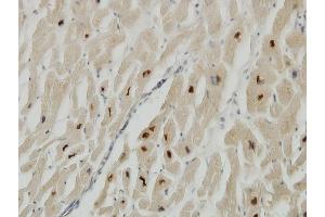 Immunoperoxidase of monoclonal antibody to TTN on formalin-fixed paraffin-embedded human heart. (Titin antibody  (AA 1-110))