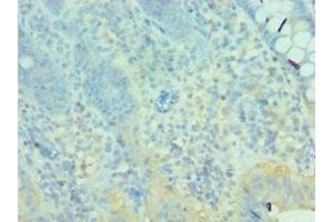 Immunohistochemistry of paraffin-embedded human epityphlon tissue using ABIN7160627 at dilution of 1:100 (MTM1 antibody  (AA 484-603))