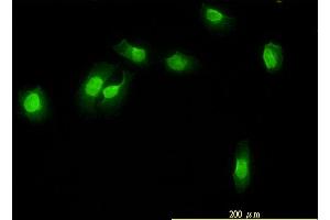 Immunofluorescence of monoclonal antibody to WDR61 on HeLa cell. (WDR61 antibody  (AA 1-305))