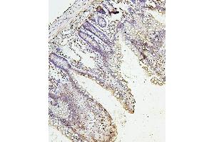 IHC analysis of H1F0 using anti-H1F0 antibody (ABIN7600521). (Histone H1 antibody  (AA 20-159))