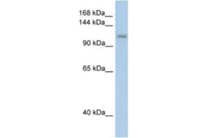 Western Blotting (WB) image for anti-PRP6 Pre-mRNA Processing Factor 6 Homolog (PRPF6) antibody (ABIN2462244) (PRP6/ANT-1 antibody)