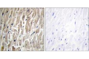 Immunohistochemistry (Paraffin-embedded Sections) (IHC (p)) image for anti-Cytochrome P450, Family 2, Subfamily J, Polypeptide 2 (CYP2J2) (AA 231-280) antibody (ABIN2889947) (CYP2J2 antibody  (AA 231-280))