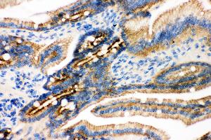 Anti- gamma Catenin Picoband antibody, IHC(P) IHC(P): Mouse Intestine Tissue (JUP antibody  (AA 556-745))