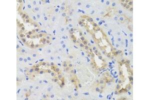 Immunohistochemistry of paraffin-embedded Rat kidney using DISC1 Polyclonal Antibody at dilution of 1:100 (40x lens). (DISC1 antibody)