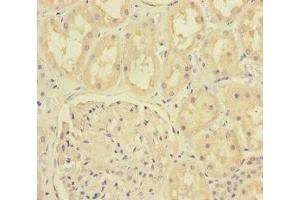 Immunohistochemistry of paraffin-embedded human kidney tissue using ABIN7165835 at dilution of 1:100 (MTO1 antibody  (AA 420-680))