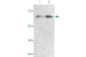 Western blot analysis of Lane 1: 293 cells, Lane 2: serum treated 293 cells with FOXO4 (phospho S197) polyclonal antibody  at 1:500-1:1000 dilution. (FOXO4 antibody  (pSer197))