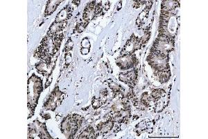 IHC analysis of MBNL1 using anti-MBNL1 antibody (ABIN7602608).