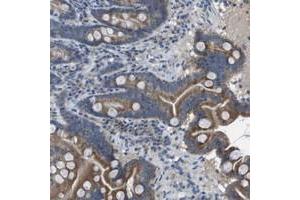 Immunohistochemical staining of human duodenum with CLCA4 polyclonal antibody  shows moderate cytoplasmic positivity in glandular cells at 1:10-1:20 dilution.