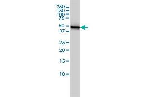 Western Blotting (WB) image for anti-Keratin 18 (KRT18) (AA 1-431) antibody (ABIN598778) (Cytokeratin 18 antibody  (AA 1-431))