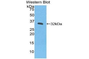 Western Blotting (WB) image for anti-Janus Kinase 3 (JAK3) (AA 716-967) antibody (ABIN1859526)