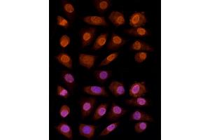 Immunofluorescence analysis of L929 cells using CRYGC antibody (ABIN6130868, ABIN6139079, ABIN6139080 and ABIN6224977) at dilution of 1:100 (40x lens). (CRYGC antibody  (AA 1-174))