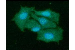 ICC/IF analysis of KIR2DL1 in Hep3B cells line, stained with DAPI (Blue) for nucleus staining and monoclonal anti-human KIR2DL1 antibody (1:100) with goat anti-mouse IgG-Alexa fluor 488 conjugate (Green). (KIR2DL1 antibody)
