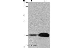 Western blot analysis of Mouse kidney and human kidney tissue, using FHIT Polyclonal Antibody at dilution of 1:600 (FHIT antibody)