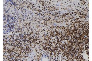 ABIN6272499 at 1/100 staining Human spleen tissue by IHC-P. (CD164L2 antibody)