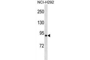 Western Blotting (WB) image for anti-Acyl-CoA Synthetase Long-Chain Family Member 1 (Acsl1) antibody (ABIN3001409)