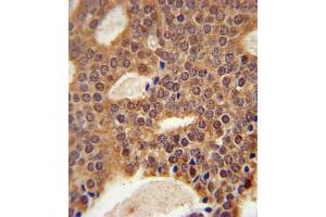 Immunohistochemistry (IHC) image for anti-DNA Cross-Link Repair 1B (DCLRE1B) antibody (ABIN3002342) (DCLRE1B antibody)