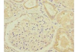 Immunohistochemistry of paraffin-embedded human kidney tissue using ABIN7154322 at dilution of 1:100 (GBF1 antibody  (AA 1-85))