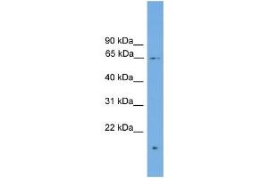 WB Suggested Anti-ZNF320 Antibody Titration: 0. (ZNF320 antibody  (N-Term))