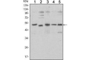Western blot analysis using SMAD5 mouse mAb against Hela (1), SK-N-SH (2), PC-12 (3), Jurkat (4), and K562 (5) cell lysate.