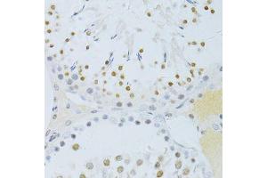 Immunohistochemistry of paraffin-embedded rat testis using Phospho-RELA-S276 antibody (ABIN6003884) at dilution of 1/100 (40x lens). (NF-kB p65 antibody  (pSer276))