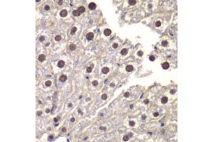Immunohistochemistry of paraffin-embedded mouse liver using ST14 antibody at dilution of 1:200 (400x lens). (ST14 antibody)