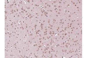 Paraformaldehyde-fixed, paraffin embedded mouse brain, Antigen retrieval by boiling in sodium citrate buffer (pH6) for 15min, Block endogenous peroxidase by 3% hydrogen peroxide for 30 minutes, Blocking buffer (normal goat serum) at 37°C for 20min, Antibody incubation with IKK Alpha + IKK beta Polyclonal Antibody  at 1:400 overnight at 4°C, followed by a conjugated secondary and DAB staining. (IKK-alpha /IKK-beta antibody  (AA 151-250))