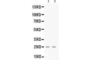 Western blot analysis of GRO gamma expression in mouse lung extract ( Lane 1) and mouse spleen extract ( Lane 2). (CXCL3 antibody  (AA 32-100))