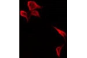 ABIN6278690 staining HepG2 by IF/ICC. (KR1_HHV11 antibody)