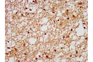 IHC image of ABIN7153159 diluted at 1:400 and staining in paraffin-embedded human brain tissue performed on a Leica BondTM system. (FFAR1 antibody  (AA 143-178))
