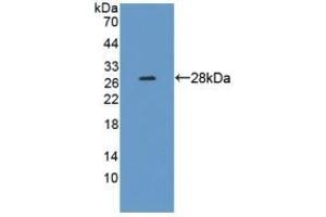 Detection of Recombinant CRMP1, Human using Polyclonal Antibody to Collapsin Response Mediator Protein 1 (CRMP1) (CRMP1 antibody  (AA 1-250))