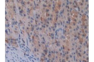 Immunohistochemistry (IHC) image for anti-Signal Transducer and Activator of Transcription 2, 113kDa (STAT2) (AA 587-838) antibody (ABIN7443368)