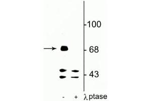 Western blot of rat hippocampal lysate showing specific immunolabeling of the ~71 kDa FMRP protein phosphorylated at Ser499 in the first lane (-). (FMR1 antibody  (pSer499))