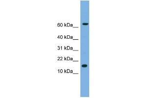 WB Suggested Anti-IL1B Antibody Titration: 0. (IL-1 beta antibody  (N-Term))