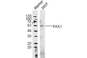 (Human Cell line) 293T lysates probed with PAX1 Polyclonal Antibody, unconjugated  at 1:300 overnight at 4°C followed by a conjugated secondary antibody at 1:10000 for 60 minutes at 37°C. (PAX1 antibody  (AA 151-250))