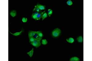 Immunofluorescence staining of MCF-7 cells with ABIN7142736 at 1:83, counter-stained with DAPI. (RPL11 antibody  (AA 3-178))