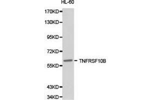 Western Blotting (WB) image for anti-Tumor Necrosis Factor Receptor Superfamily, Member 10b (TNFRSF10B) antibody (ABIN1875126) (TNFRSF10B antibody)