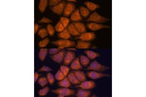 Immunofluorescence analysis of HeLa cells using UPF3A antibody (ABIN7271227) at dilution of 1:100.