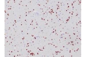 Immunohistochemistry (IHC) image for anti-Oligodendrocyte Lineage Transcription Factor 2 (OLIG2) (AA 200-300) antibody (ABIN7504157)