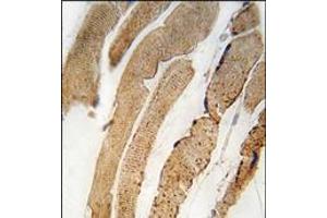 Formalin-fixed and paraffin-embedded human skeletal muscle tissue reacted with PDK4 antibody (Center), which was peroxidase-conjugated to the secondary antibody, followed by DAB staining. (PDK4 antibody  (Middle Region))
