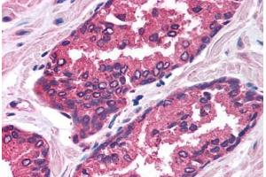Human Prostate (formalin-fixed, paraffin-embedded) stained with FOXP2 antibody ABIN214758 at 2. (FOXP2 antibody  (AA 71-120))