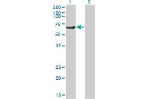 Western Blot analysis of TRIM16 expression in transfected 293T cell line by TRIM16 monoclonal antibody (M01), clone 5F4. (TRIM16 antibody  (AA 165-273))