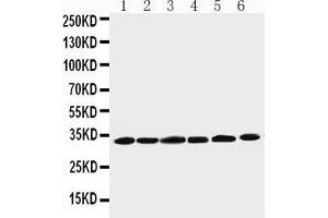 Anti-Cyclin D1 antibody,  Western blotting Lane 1: Rat Testis Tissue Lysate Lane 2: Rat Ovary Tissue Lysate Lane 3: Rat Brain Tissue Lysate Lane 4: HELA Cell Lysate Lane 5: MM231 Cell Lysate Lane 6: SW620 Cell Lysate (Cyclin D1 antibody  (C-Term))