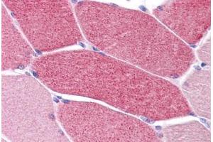 Human Skeletal Muscle: Formalin-Fixed, Paraffin-Embedded (FFPE) (LRRC19 antibody  (C-Term))