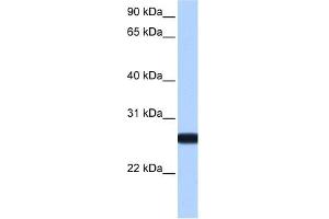 IL13RA2 antibody used at 1 ug/ml to detect target protein. (IL13RA2 antibody  (N-Term))