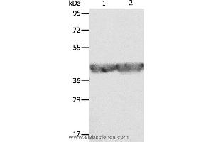 Western blot analysis of A549 and hela cell, using ALDOA Polyclonal Antibody at dilution of 1:500
