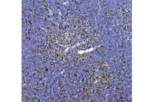 IHC analysis of ARID1A using anti-ARID1A antibody (ABIN7602567). (ARID1A antibody  (AA 857-1552))