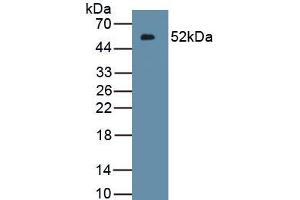 Detection of Recombinant IFNk, Human using Polyclonal Antibody to Interferon Kappa (IFNk) (IFNK antibody  (AA 28-207))