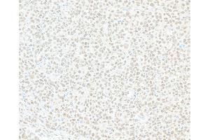 anti-K(lysine) Acetyltransferase 8 (KAT8) (AA 1-50) antibody